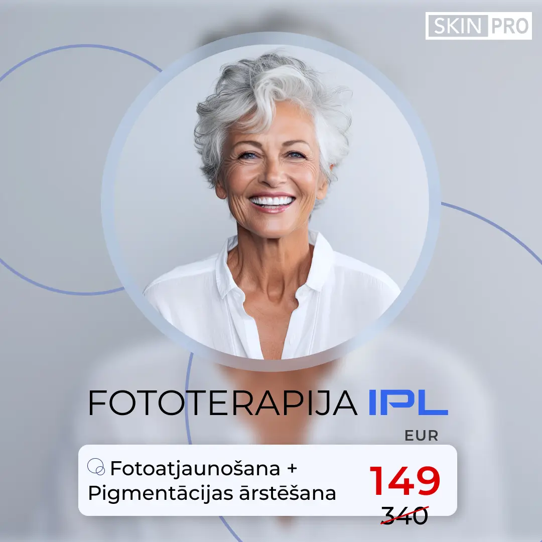 IPL Fotoatjaunošana un pigmentācijas ārstēšana